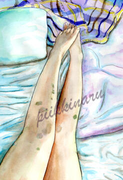 Bruises